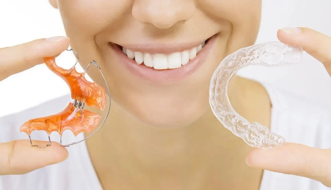 retainers by NYC Dental Lounge