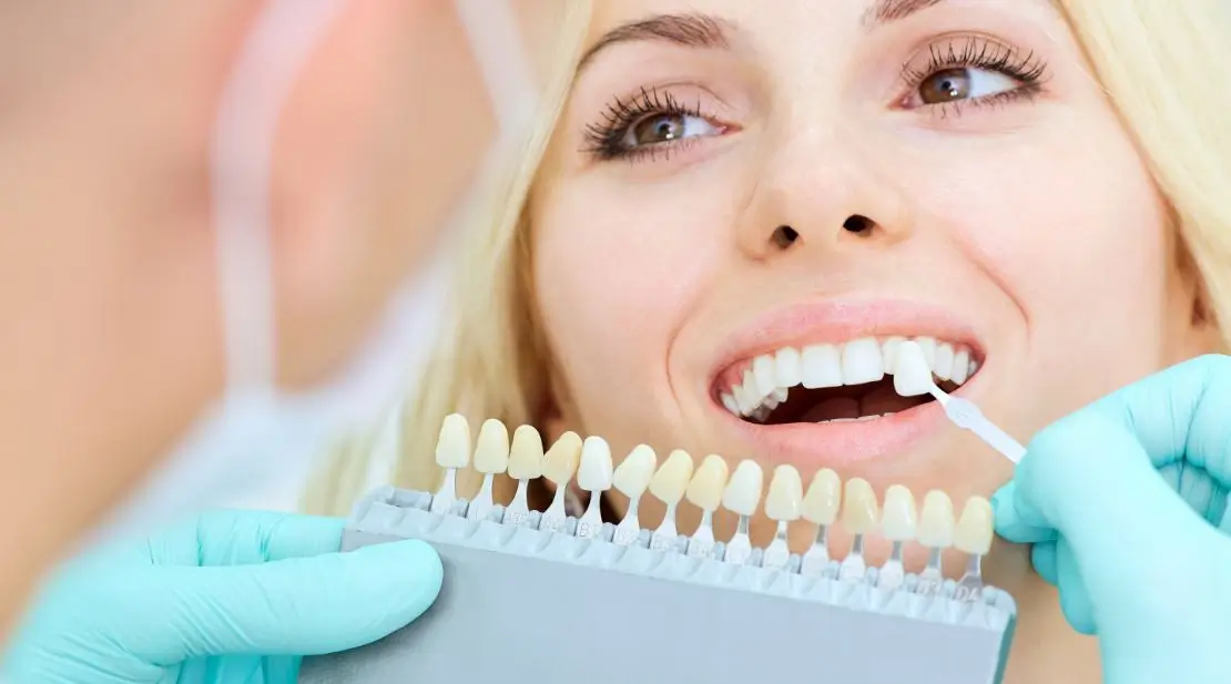 teeth whitening by NYC Dental Lounge